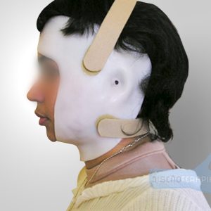 Órtesis cervical
