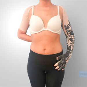 Prendas de compresión para linfedema