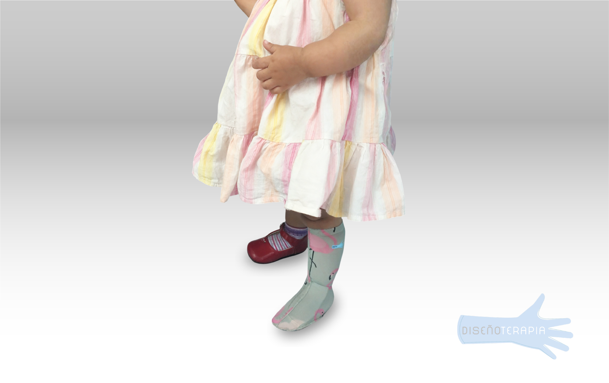 Prendas de compresión post quemaduras